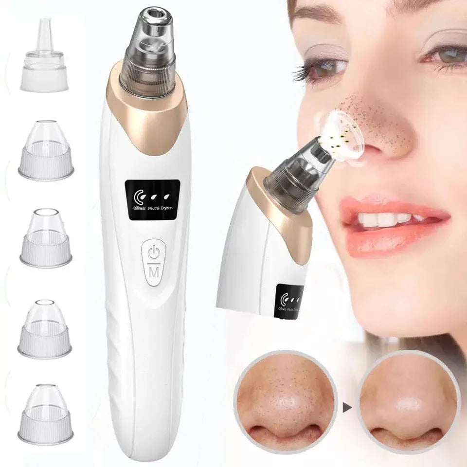 5 in 1 Electric Blackhead Remover